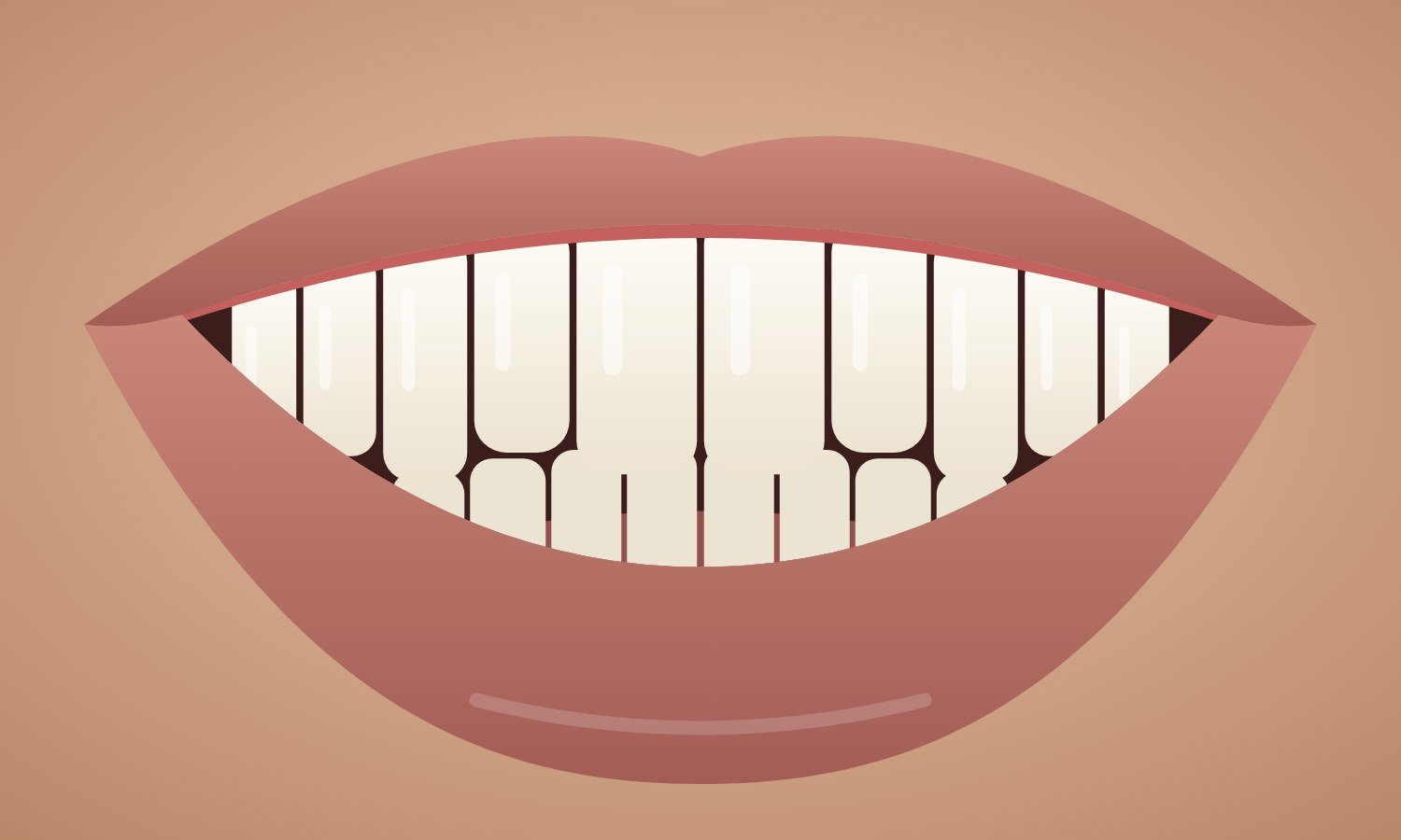 After: even, bright white smile