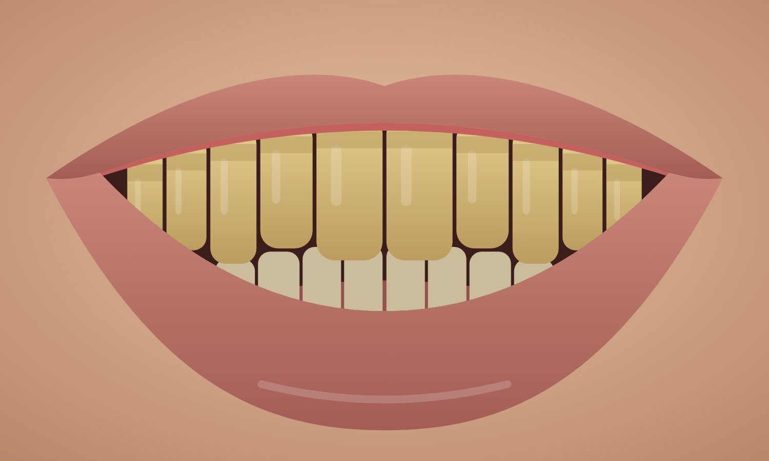Before: stained, yellowed teeth